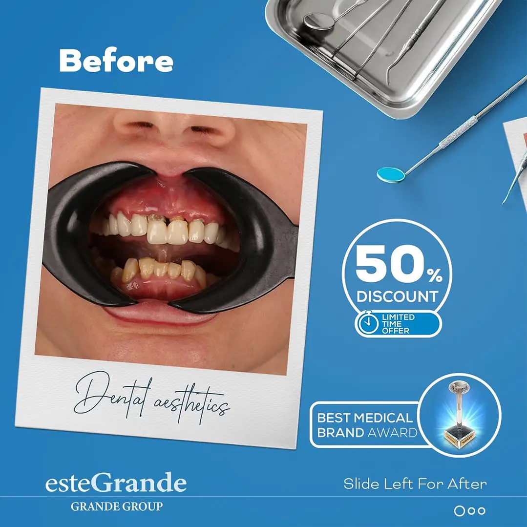 DENTAL-transplant-07