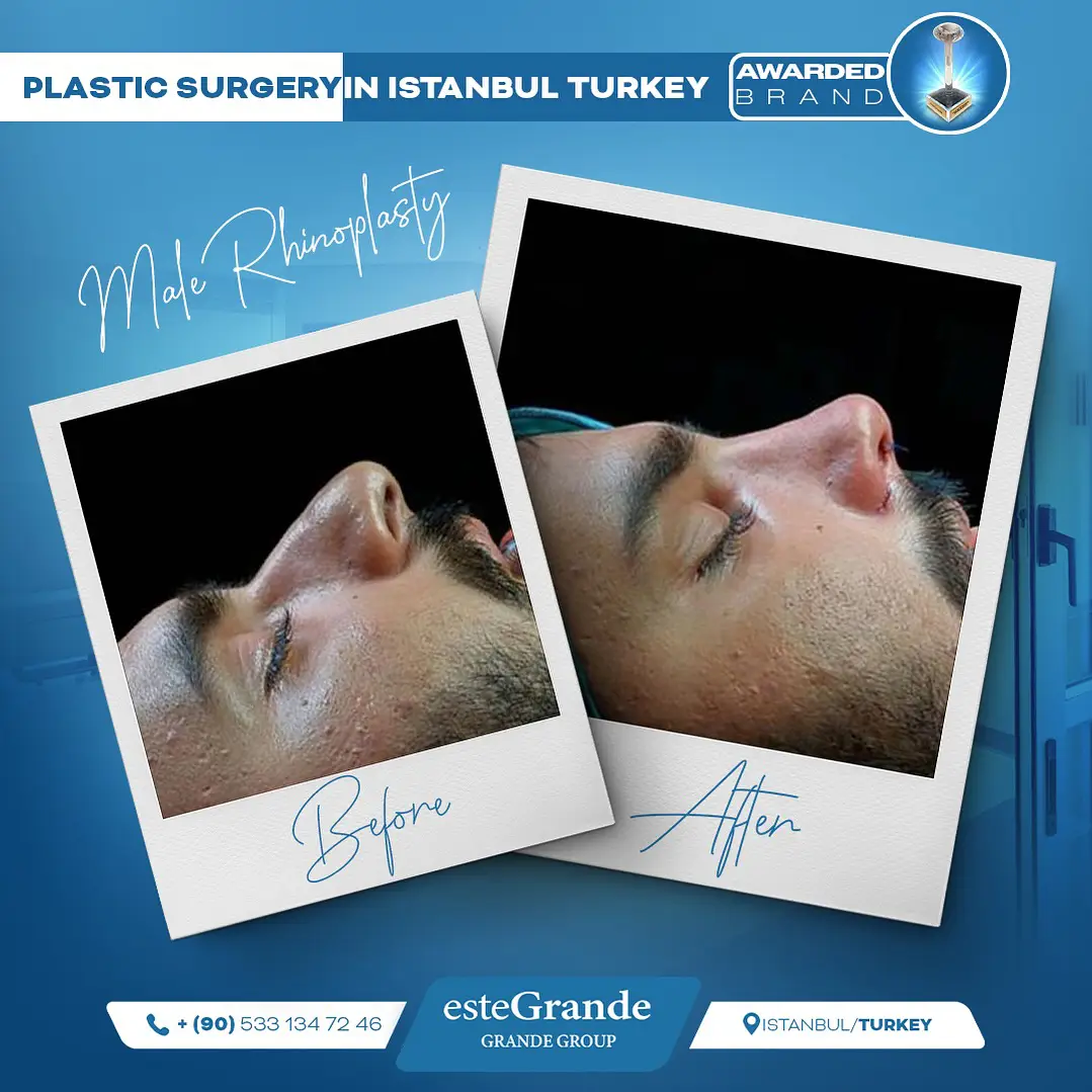 Plastic Surgery Gallery-02