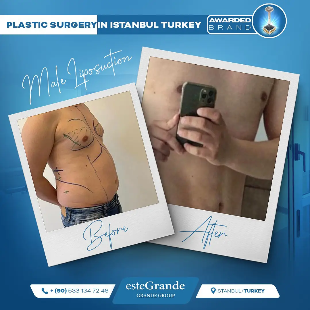 Plastic Surgery Gallery-03