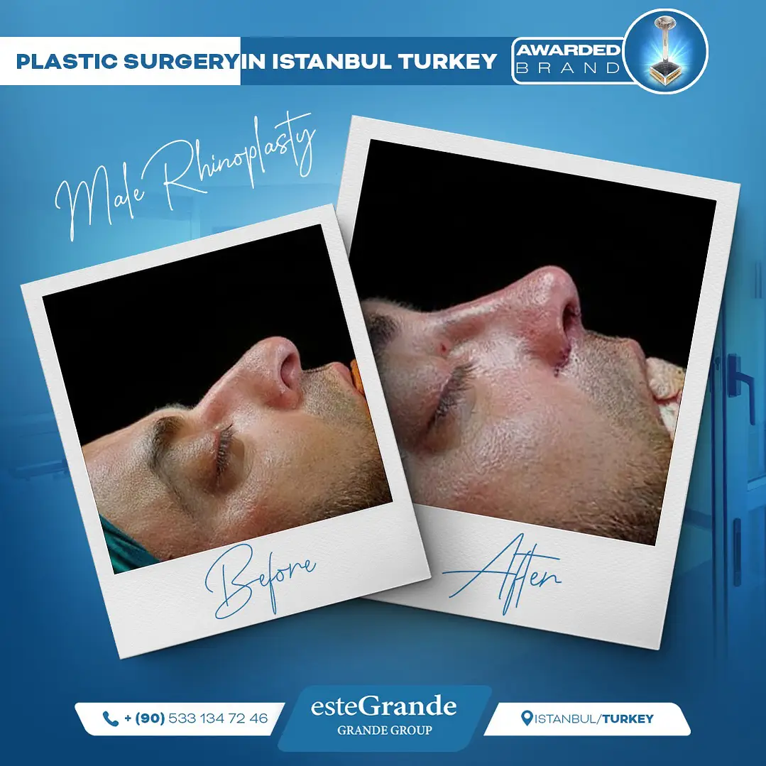 Plastic Surgery Gallery-05